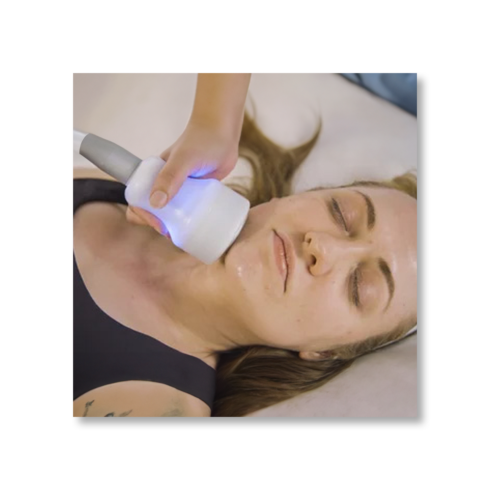 Cryo T-Shock Facial (Small Body Area) 5 & 10 Pack