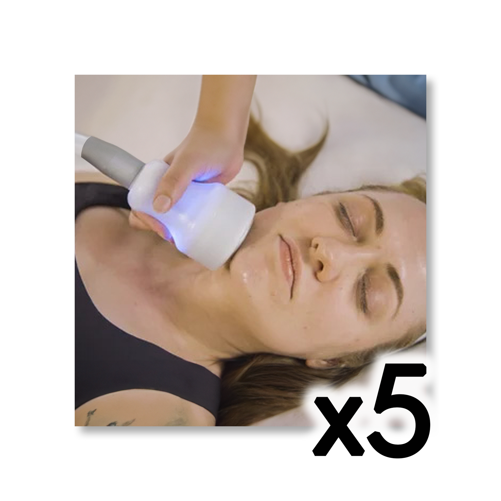 Cryo T-Shock Facial (Small Body Area) 5 & 10 Pack